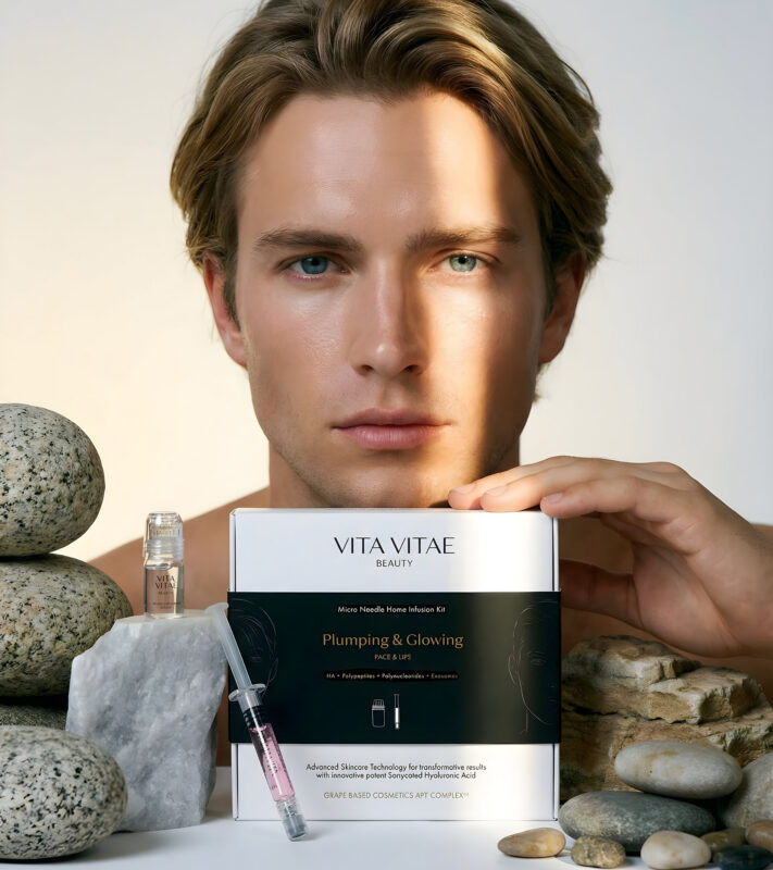 benefici microneedling a casa